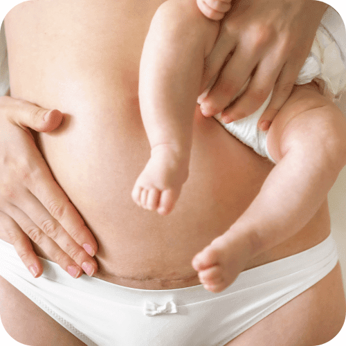 Preparing for a C-Section? Here’s What You’ll Want in Your Bag
